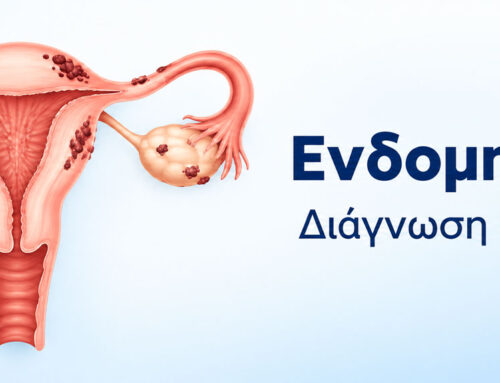 Ενδομητρίωση: Πώς ανιχνεύεται και ποιες εξετάσεις χρειάζονται;